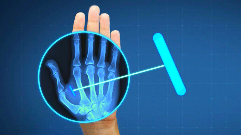 Чипизация населения 2020