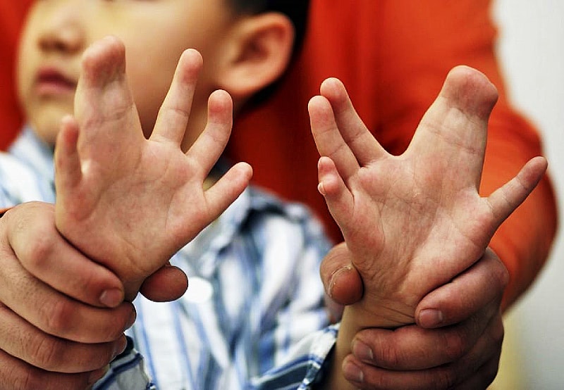 Мутации человека в Индии