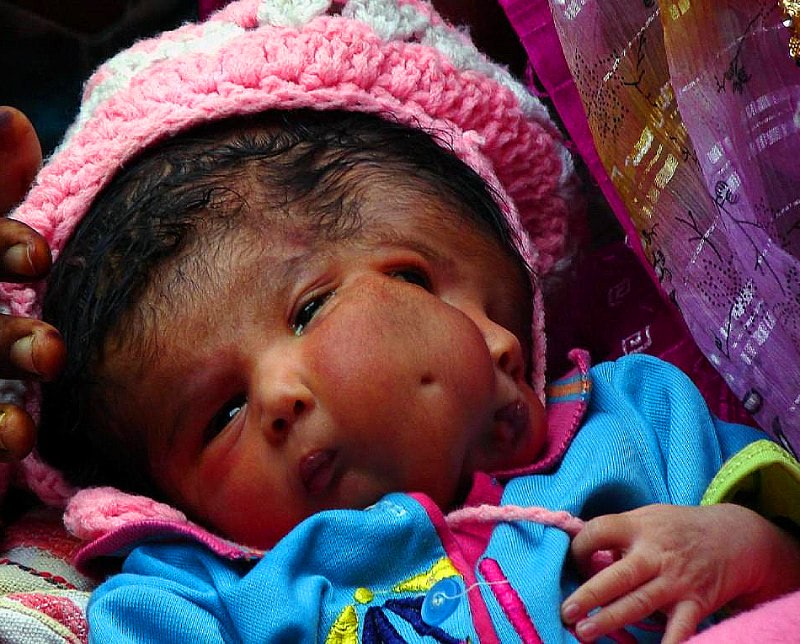 Мутации причины