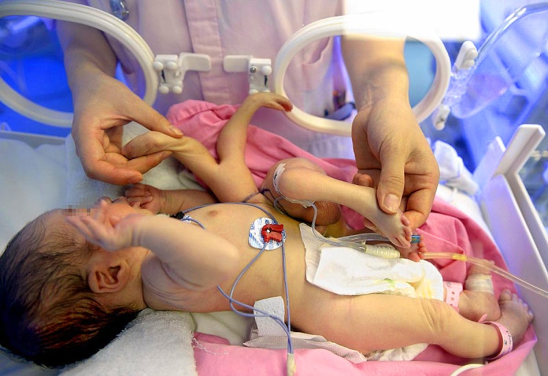 Мутации у детей в Индии